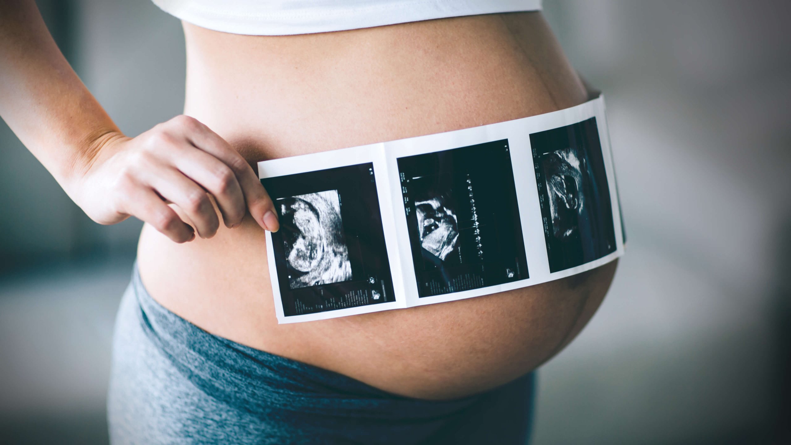 The Role of Private Pregnancy Scans in Bonding with Your Unborn Baby